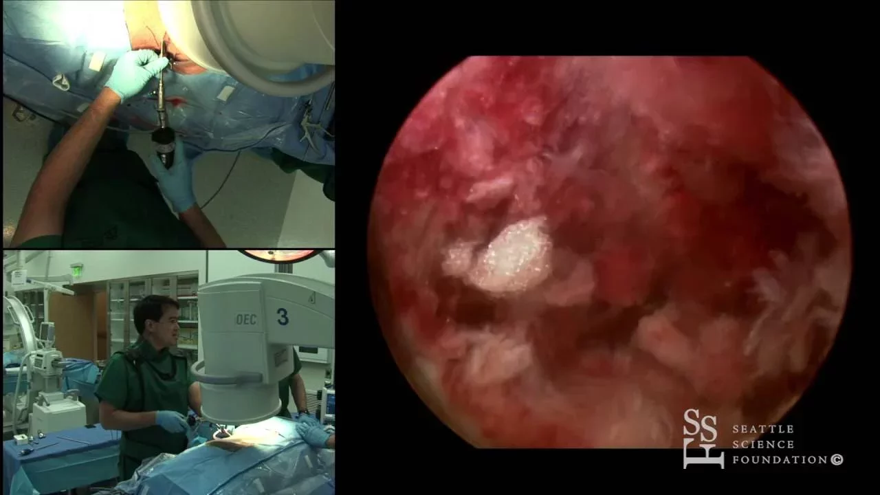 Lumbar Radiculopathy for the USMLE Step 1. 