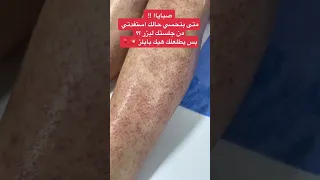 الجسم بعد الليزر Shorts 