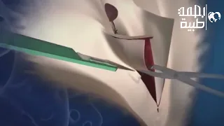 شاهد عملية تحويل الرجل الي انثي مشاهد تعرض لأول مرة 