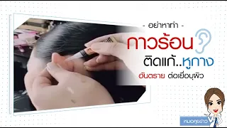 ถ้ากาวตราช้างติดตาหรือติดผิวหนังโดยไม่ตั้งใจ ควรทำอย่างไรเบื้องต้น