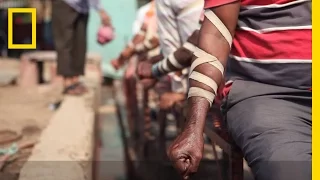 Download WATCH: The Practice of Bloodletting in New Delhi | National Geographic MP3