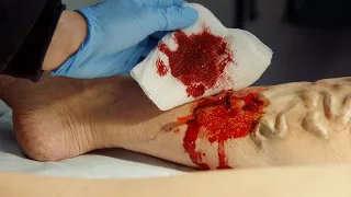 PARAMEDIC's SHOCKING Find ! #911