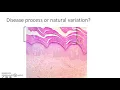 Dermatopathology 1 Dr Magda Assaf stratum corneum