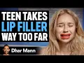 Girl Takes LIP FILLER Way Too Far Dhar Mann Studios