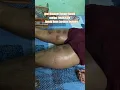 Best Massage Therapy in Ranchi