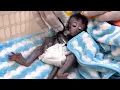 Download Lagu Omg🥹My heart is so broken, the moment the little monkey Robin underwent surgery and was amputated