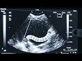 Scanning Stomach for kids scanning