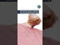 This is how venom s released into the skin during bee sting