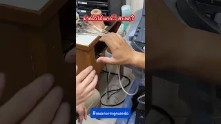  ทำไมการล้มแล้วใช้นิ้วโป้งยันพื้นถึงทำให้เกิดอาการปวดที่นิ้วโป้ง 