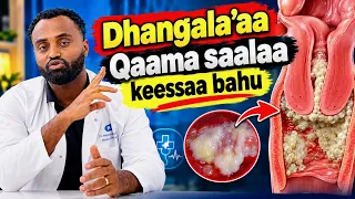 Dhangala’aa addaa Qaama saalaa dubartootaa keessaa bahuuf furmaanni maali ?