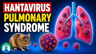 Hantavirus Pulmonary Syndrome (HPS): Symptoms, Causes, and Prevention