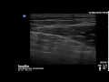 Normal Soft Tissue US