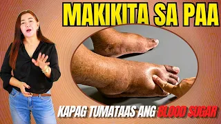 7 Kakaibang Palatandaan sa Paa na Ibig Sabihin na Tumataas ang Sugar Mo. | Doc Cherry