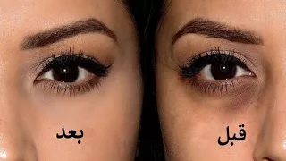 هل تعلم على ماذا يدل السواد أسفل العينين   لن تصدق  دندنها