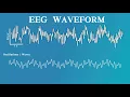 EEG for Anesthesiology - Part 2 The EEG Waveform and Spectrogram