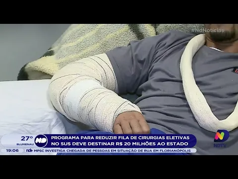 Programa para reduzir fila de cirurgias eletivas no SUS deve destinar R$ 20 milhões ao estado