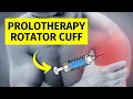Dextrose Prolotherapy for Rotator Cuff and Shoulder Pain