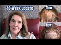 48 Week Hair Growth Update What s Working My Results