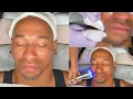 Bro Facial Mens Facial with Extractions Ultrasound High Freq