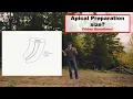 Apical Preparation Size Friday Questions