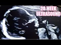 Lagu 20 WEEK ULTRASOUND - HALF WAY PREGNANT
