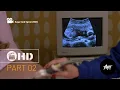 Download Lagu Movie: Sugar And Spice (2001) pregnant scene (02/03) #pregnant #babybump #movie #checkup 