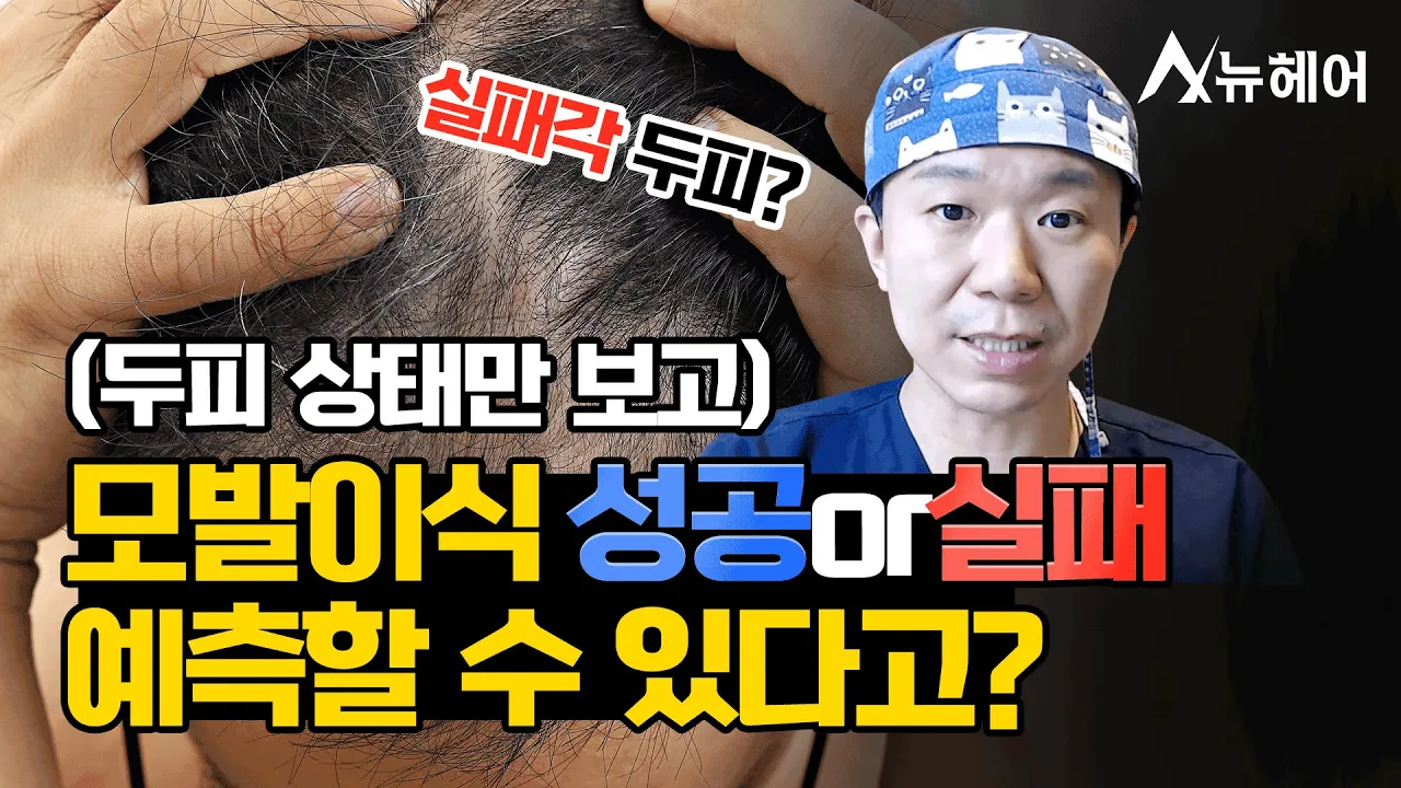 두피 상태만 보고 모발이식 결과를 미리 알 수 있다?ㅣ뉴헤어