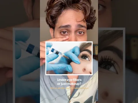 Under eye fillers or just makeup?