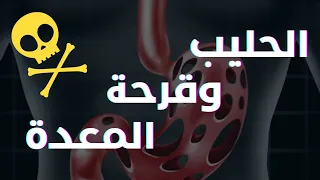اللبن وعلاقته بقرحة المعدة اعراض قرحة المعدة امراض المعدة والحليب اعراض ارتجاع المرئ 