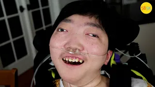 He's Missing Most of His Brain But Surprised Everyone