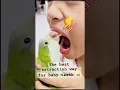 The best way removal baby tooth