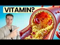 Download Lagu Najmoćniji vitamin za čišćenje arterija nakon 50. godine!