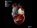 Who Told You (feat. Drake) - J Hus