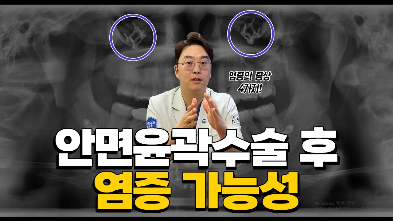 안면윤곽(광대, 사각턱, 턱끝) 수술 후 염증이 일어날 확률은?
