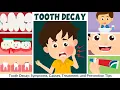 Tooth Decay Symptoms Causes Treatment and Prevention for Kids Learning Junction