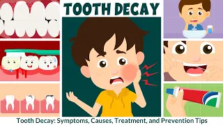 Tooth Decay Symptoms Causes Treatment and Prevention for Kids Learning Junction
