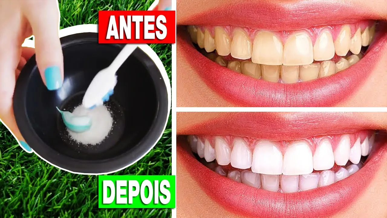 Água Oxigenada pra CLAREAR OS DENTES funciona (SURPREENDA-SE)? Água Oxigenada deixa os dente branco?