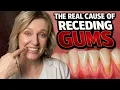 The Real Reason Your Gums Keep Receding Most Dentists Miss This