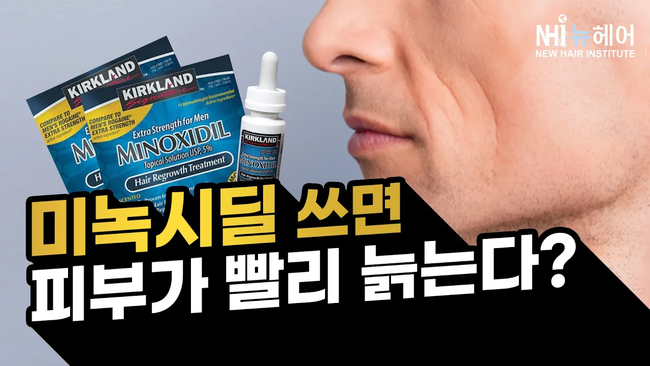 미녹시딜 쓰면 노화와요? - 뉴헤어 I 탈모치료