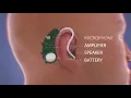 Lagu How Do Hearing Aids Work Video