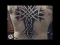A Vita Tattoo - Incredible Results - Rensselaer NY 12144