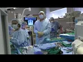Francis P Sutter DO FACS Cardiac Surgery