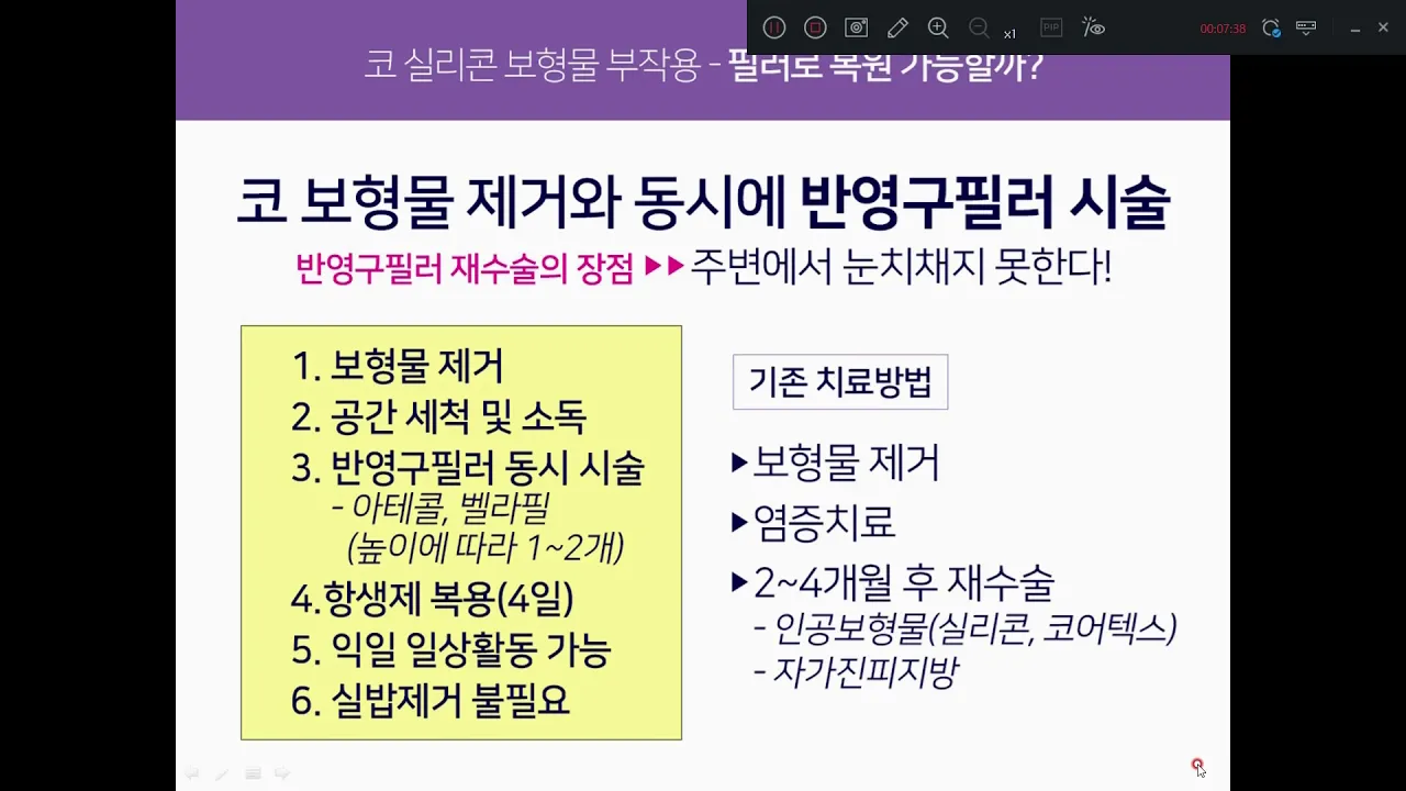 코성형 부작용 간단하게 필러로 교정할수 있을까?'