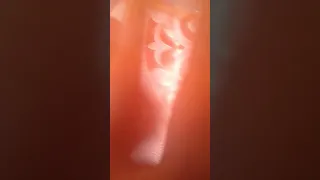 مجنون وماشي في صيدلية دندنها