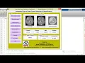 Brain Tumor Detection and Classification of tumor types Using Matlab Code