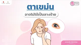 ตากระตุกหรือตาเขม็นเกิดจากอะไรบ้าง