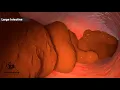 Download Lagu How does your body turns food into the poop? Human digestive system(Animation)|Dandelion Team