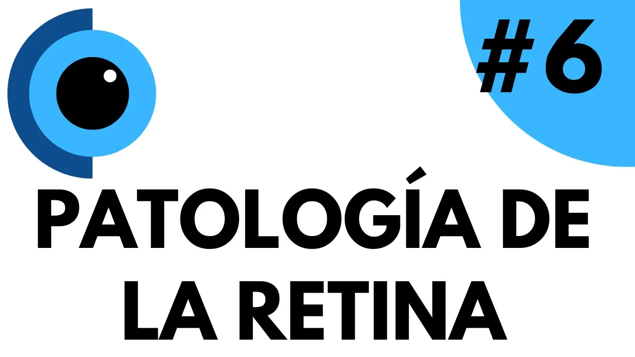 #6 Patología de la retina (Desprendimiento de retina y Maculopatías) | Prof. Manuel Díaz Llopis