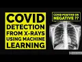 COVID DETECTION from X-RAYS using CNNs DEEP LEARNING PROJECT IMAGE CLASSIFICATION