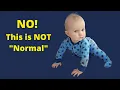 Baby Crawling With One Leg - No this is not normal Atypical Crawling